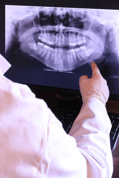 Best Emergency Tooth Extraction  in Green, OH