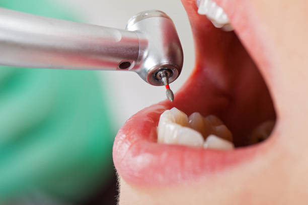 Best Knocked-Out Tooth Emergency  in Green, OH